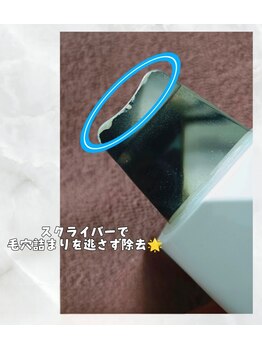 ビメンズ(BiMen's)/スクライバーで毛穴詰まり解消☆