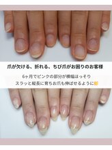 サロン アムール(amour)/自爪育成ビフォーアフター