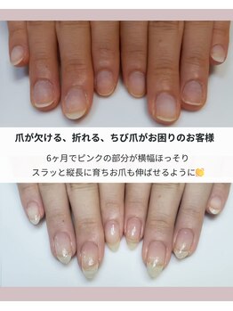 サロン アムール(amour)/自爪育成ビフォーアフター