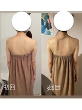 カシェット(cachette)/ブライダルエステ