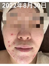 ナヴィータ アオバダイ(Navita AOBADAI)/エンビロン/2ヶ月集中コース