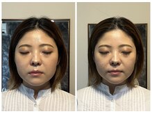 リモド(Rimodo509)/小顔矯正（ヘッドスパ