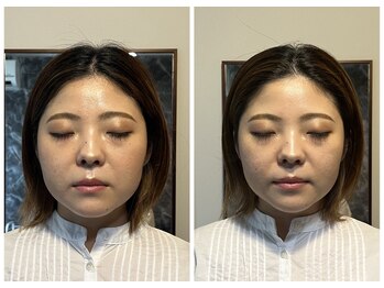 リモド(Rimodo509)/小顔矯正(ヘッドスパ