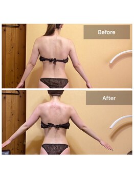 プライベートサロン アール(R)/ブライダルの方に