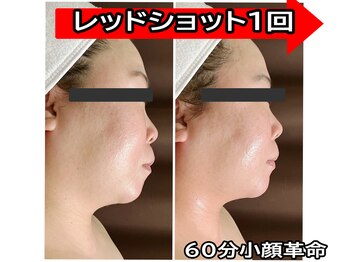 コンフィデンス 谷町四丁目店(Confidence)/