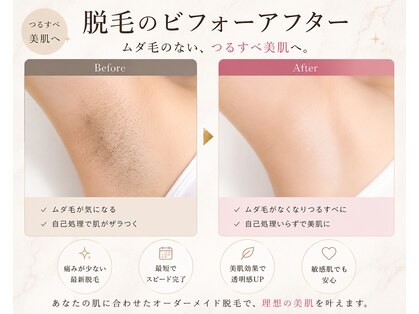 リノ 天神大名店(Lino)の写真