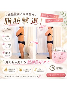ヨサパーク ベル 南森町 天満(YOSA PARK Belle)の写真/【夏直前！本気の痩身】薄着になる準備はOK？速攻デトックス＆滝汗燃焼で自分史上最高の「美ボディ」へ