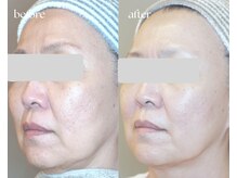 岩川治療院/５０代後半　女性のお客様