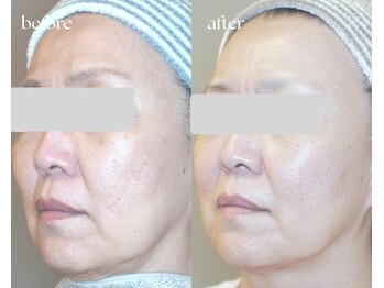 岩川治療院/50代後半 女性のお客様