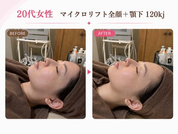 リフト 西船橋(Lift)/【西船橋】小顔・痩身専門店Lift