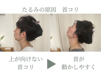 たるみアガル(たるみagaru)/板橋区　たるみ/フェイシャル