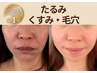 【たるみ、くすみ、毛穴の開きに】たるみ改善×プラセンタケア×ララピール