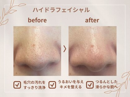 シロ(CHILO)の写真