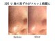 ナチュラーレ 天王寺店(Naturale)の写真/【祝27年☆4.8】1回で透明感の肌質を実感★毛穴洗浄ピーリング/小顔リンパ/天王寺駅2分