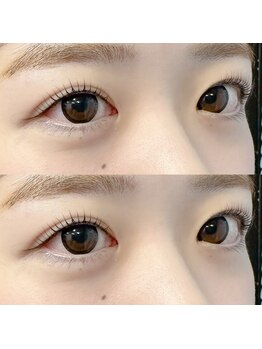 ラッシュアート(Lash art)/ラッシュリフト 根元立ち上げ