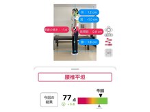 ナオル整体 大里院(NAORU整体)/AI姿勢診断【側面】