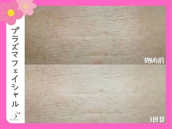 ソーハート(So Heart)/☆大人気！エイジングケアに特化