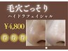 ◆モニター価格《毛穴ごっそり》ハイドラフェイシャル＋ビタミンC導入9800→