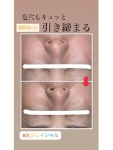 顔凛(カオリン)/毛穴もキュッと改善