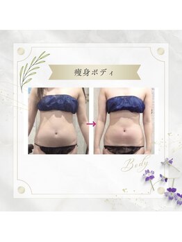 アディッシモ(addissimo)/落ちにくい下腹もスッキリ☆