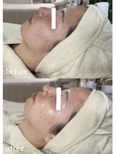 ミーミドットアイ(Mi-mi.i)/艶肌フェイシャルワックス