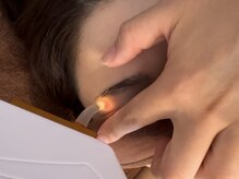 カラー(Calla)/細かい部位の脱毛