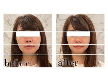 アンドボディ 横浜元町(&Body)/小顔リストアップ/横浜元町