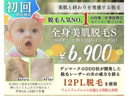 脱毛 フェイシャルサロン ケア(CARE)の写真