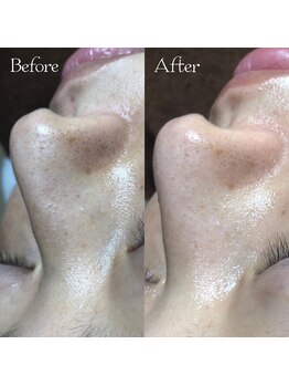 エステサロン マコ(MaCo)/40代・毛穴くすみケア