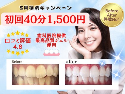 ホワイトニングショップ 福岡春日店の写真