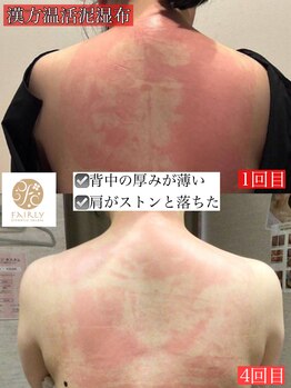 フェアリー 小松店/NEW!漢方温活泥湿布でデトックス