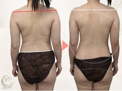 ヴェルナ(VELUNA)の写真