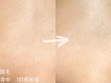 ルーナジェーナ(Luna llena)/自分で見えない場所だからこそ。