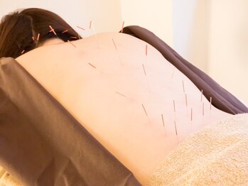 ハンドマイルド 赤坂 六本木(Hand Mild)/鍼灸+マッサージ