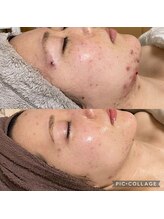 ラクシュミー ナチュラル(Laksmy NATURAL)/お客様ビフォーアフター