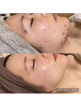 ラクシュミー ナチュラル(Laksmy NATURAL)/お客様ビフォーアフター