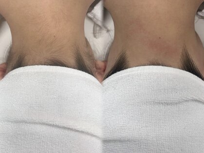 アップユー(UPU)の写真