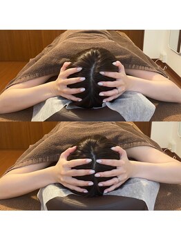 テマモリ(temamori)/施術ビフォーアフター