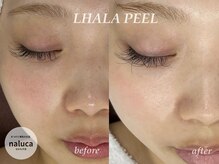 ナルカ(naluca)/【堺市・三国ヶ丘】ララピール