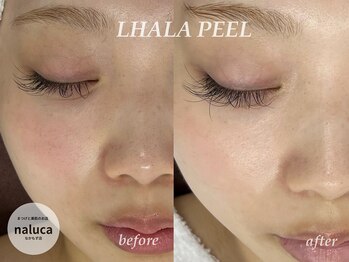 ナルカ(naluca)/【堺市・三国ヶ丘】ララピール