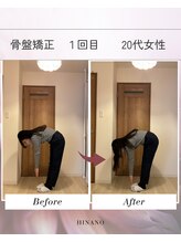 ヒナノ 矢場町店(HINANO)/骨盤矯正