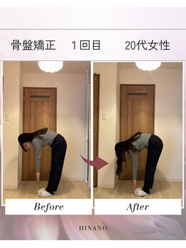 ヒナノ 矢場町店(HINANO)/骨盤矯正