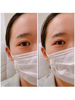 アディクト 恵比寿店(ADDICT)/お目元をさらに可愛く！