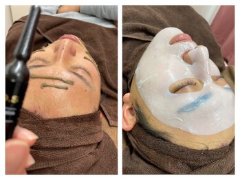 スパフランコルシャン(Spa Francorchamps)/メンズ脱毛、フェイシャル