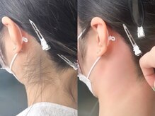 ネリネ 天神(nerine)/【うなじWax】ブライダル脱毛