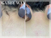 ギャビーワックス(GABBY WAX)/☆うなじ&背中脱毛☆