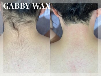 ギャビーワックス(GABBY WAX)/☆うなじ&背中脱毛☆