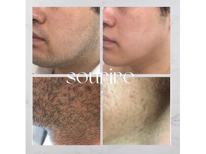スリール 麻布十番(sourire)の写真