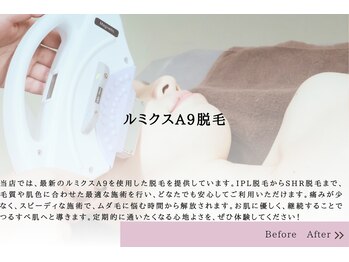 エピル(EPIL)/ルミクス脱毛導入店