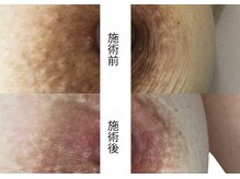 吉乃 大和高田有井店/ローマピンク　【バスト】